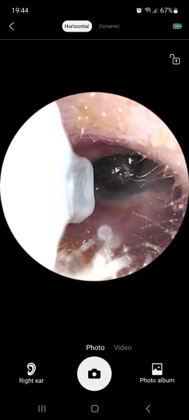 Ear scooper cameras....