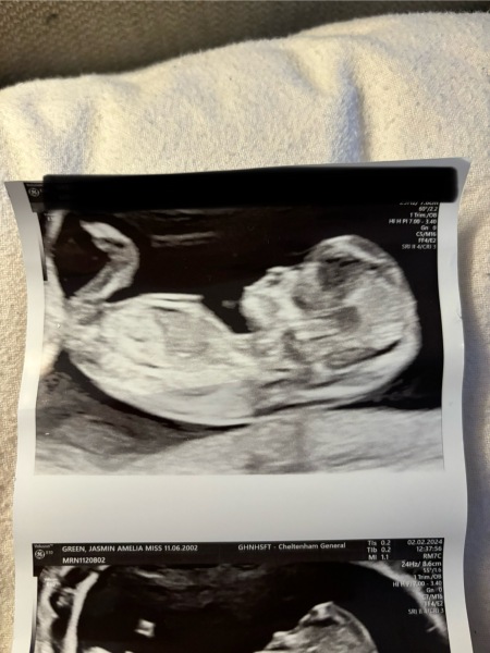 Gender scan 24th Feb! Any guesses??