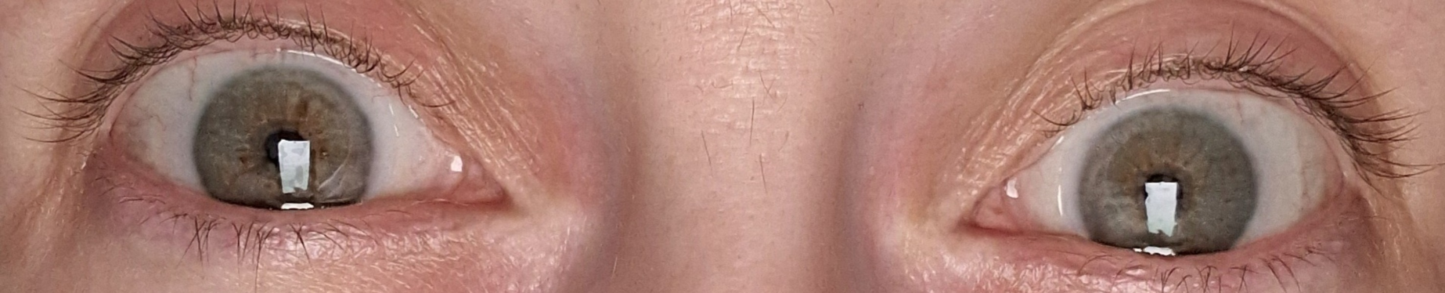Hazel or Brown? Pic included