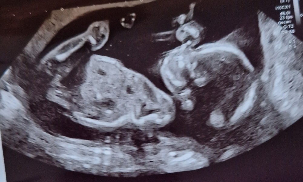Gender guesses if possible please!