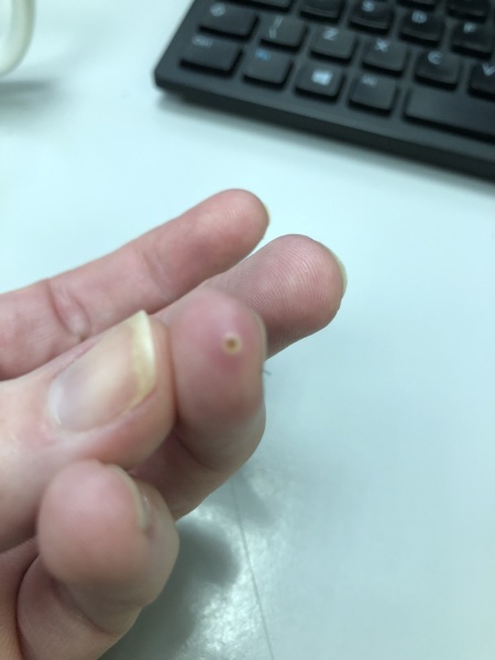 What is this?? Pic attached