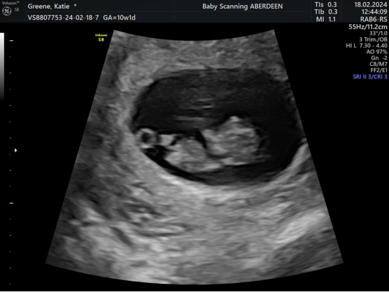 Due September 2024 - Part 4! 🤰🏻💙🩷