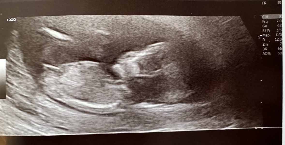 Nub/gender guesses