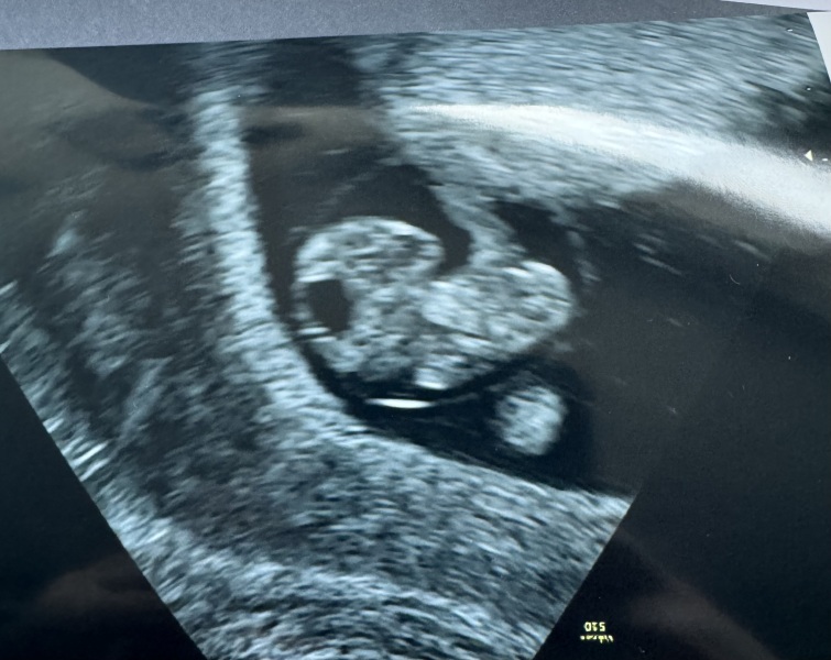 Due September 2024 PART 3 ❤️🩷💛💚💙💜