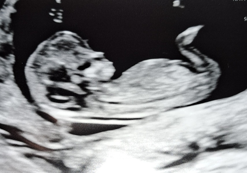 12 weeks nub theory game! (Repost)