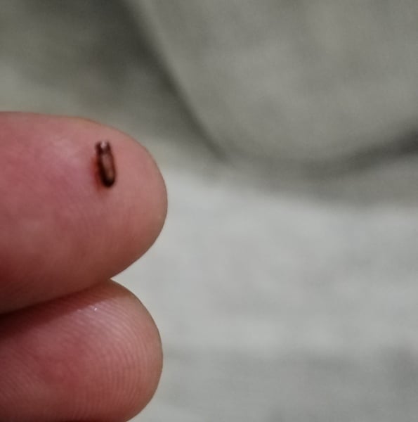 Help! Is this a bedbug?