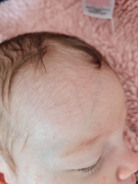 2 month old baby head banged against sofa armrest
