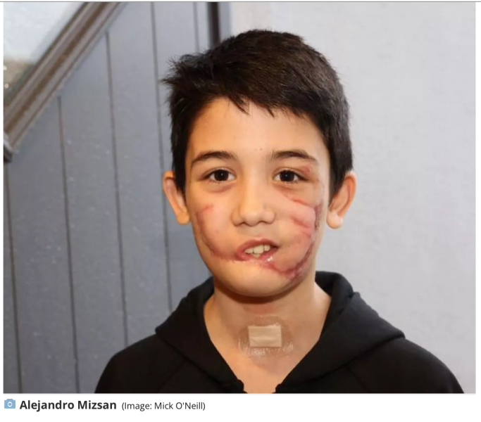 XL Bully attack | 8 year old boy seriously injured
