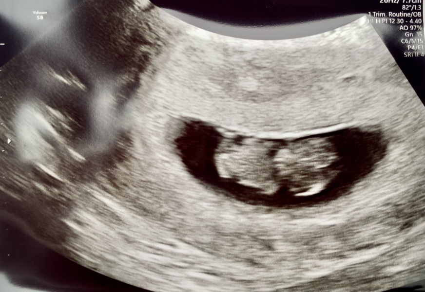 Due September 2024 PART 3 ❤️🩷💛💚💙💜