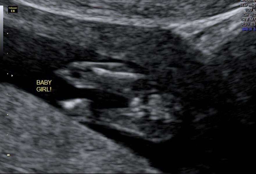Can someone help confirm gender?