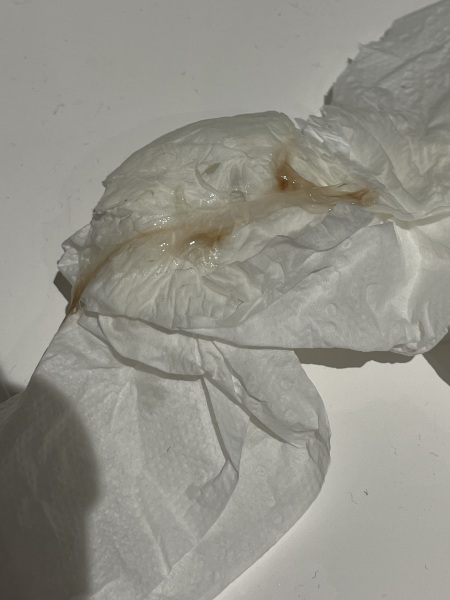Is this normal for EWCM? TMI PHOTO ATTACHED