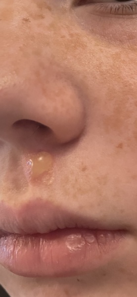 What could this be