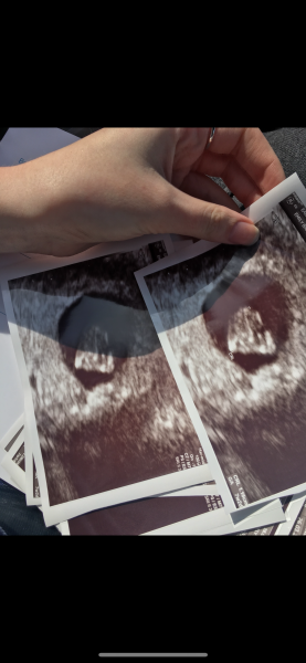 OCTOBER 2024 BABIES!