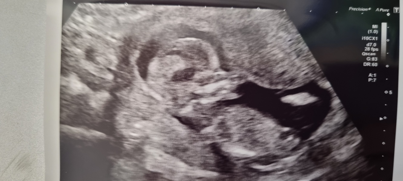 Due September 4.5 🐣♥️🧡💜