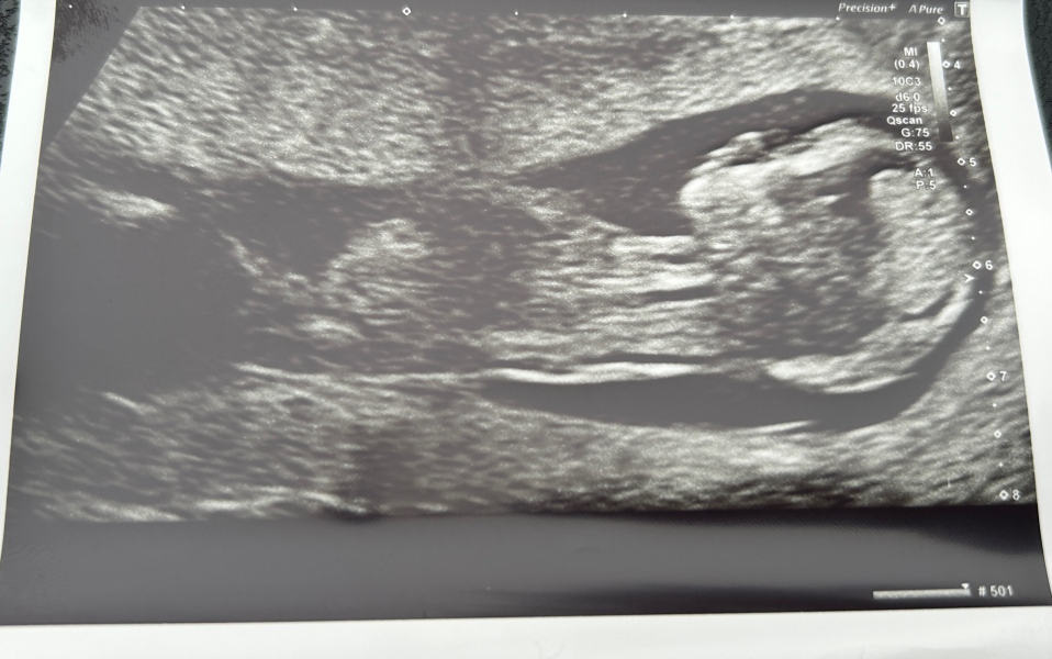 Due September 2024 - Part 4! 🤰🏻💙🩷