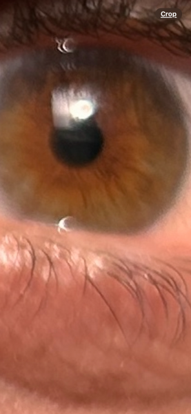 To wonder what eye colour this is?