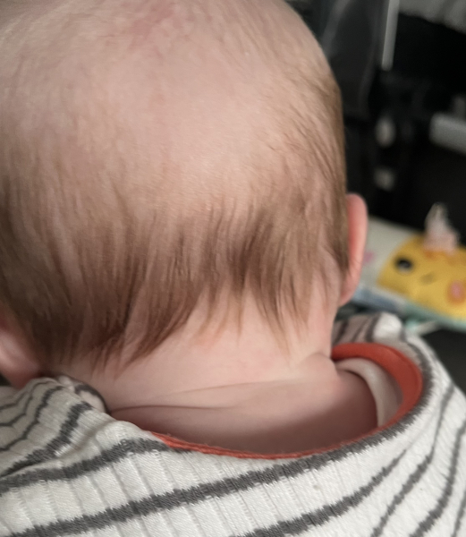 Does my child have red hair?