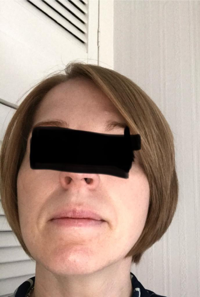 What shall I do with my hair (pics)
