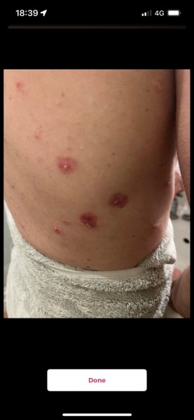 Long term itchy rash, photo inc. GP no idea