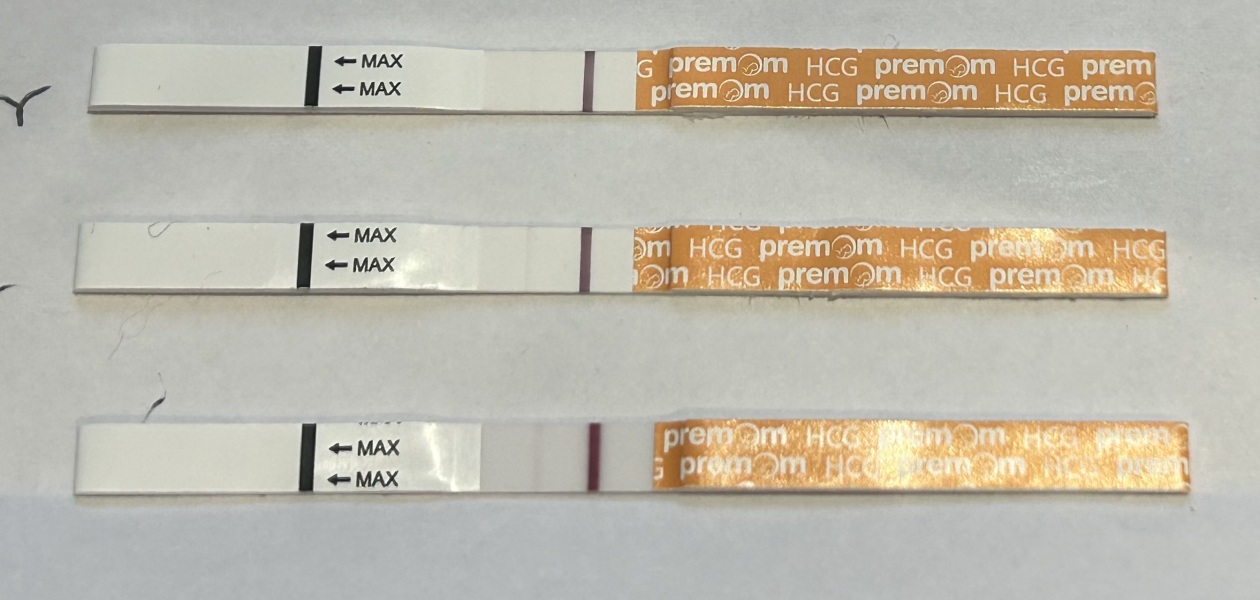 Bfp at 10/11dpo.. Could it still be from hcg trigger?