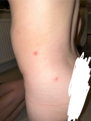 Viral rash?