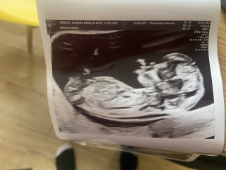 12 week nub theory/gender guesses