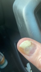 Gel Polish reaction