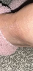 What is this on my foot?!