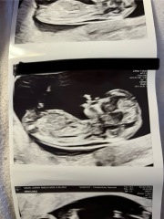 Gender scan 24th Feb! Any guesses??