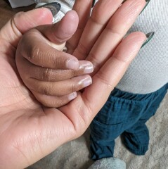 Purple lips and hands?