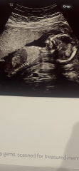 girl or boy?