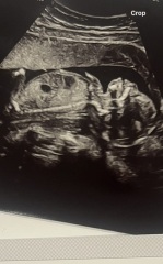 girl or boy?