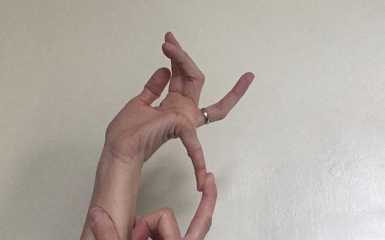 Anyone with experience of joint hypermobility or EDS?