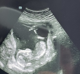 Girl or boy?