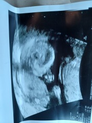 17+6 scan