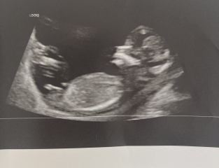 Gender Guesses!