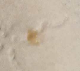 TMI Warning Cervical Discharge 11/12dpo (implantation or period?)
