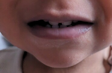 Purple lips and hands?