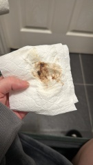 Mucus plug