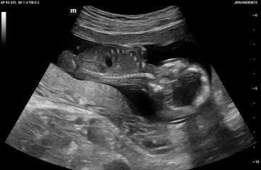 Gender guess anyone 💙🩷
