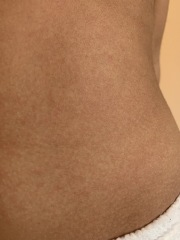 4 year old with fever and rash !