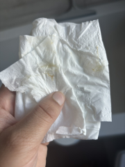 Blood streaked discharge TMI pics