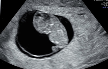 9 WEEK SCAN PICTURES PLS!!