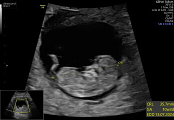 17+6 scan