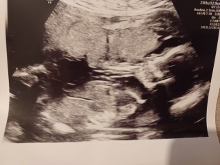 17+6 scan