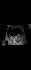 17+6 scan
