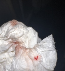 Pregnant after loss now spotting help!