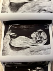 Gender scan 24th Feb! Any guesses??