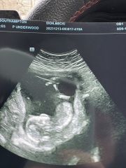 Boy/Girl Or Cord