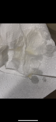 TMI picture yellow discharge ?